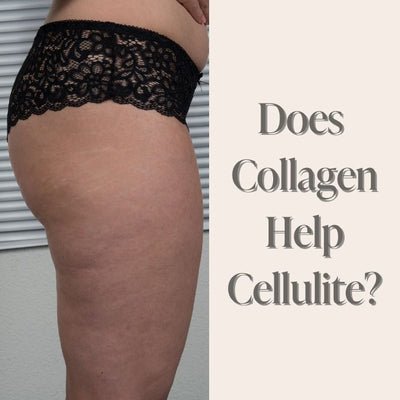 articles/Does_Collagen_Help_Cellulite.jpg