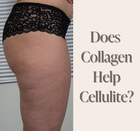 Does Collagen Help Cellulite?