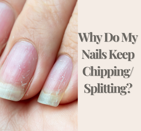Why Do My Nails Keep Chipping/Splitting?