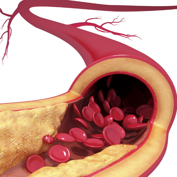 All Things Arterial Health – Perfect Supplements Australia