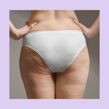 Cellulite Supplements & Vitamins